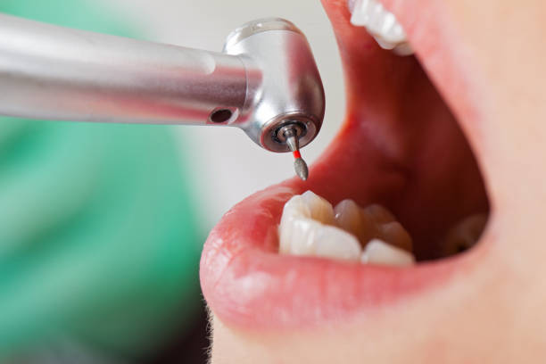 Best Emergency Treatment for Toothache in Tulsa, OK